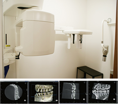 歯科用CT